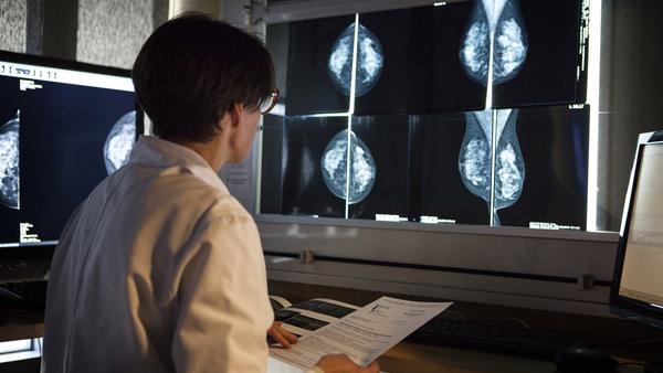 Asian women who immigrate to U.S. may have higher breast cancer risk, research finds